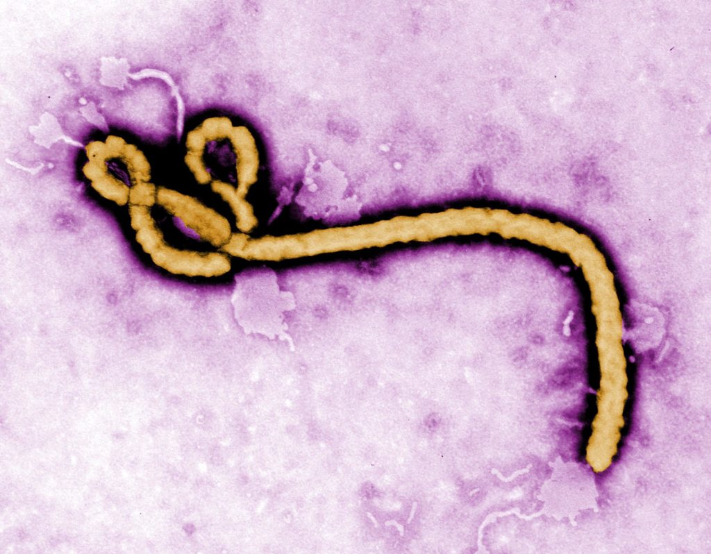 Epidemias y pandemias